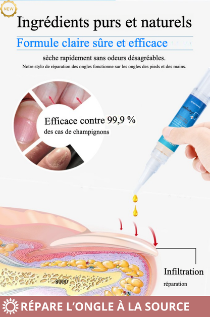 LANTHOME – Stylo Réparateur Ongles Abîmés | Rénovation Totale & Repousse Saine