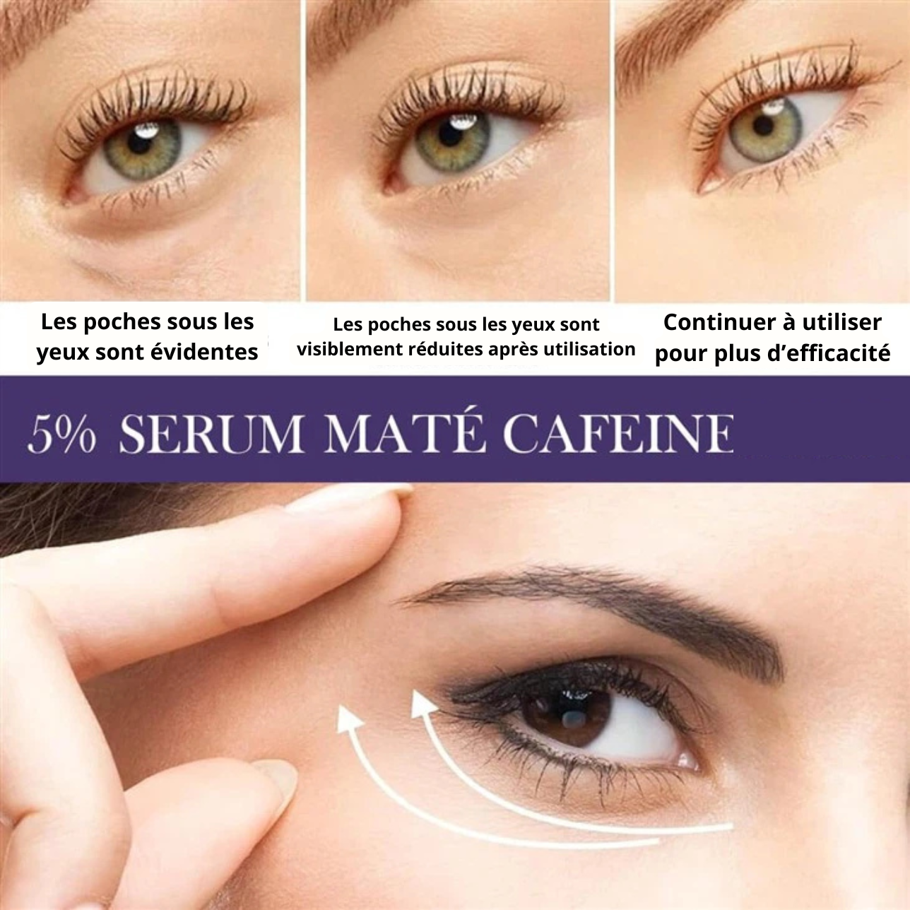 MOOYAM Sérum Contour des Yeux 360° – Anti-Cernes & Anti-Poches à la Caféine